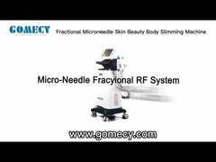 Microagujas de RF fraccionadas verticales